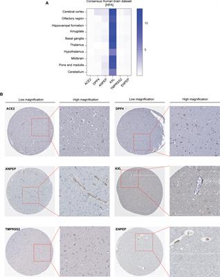 Comprehensive Oncogenic Features of Coronavirus Receptors in Glioblastoma Multiforme